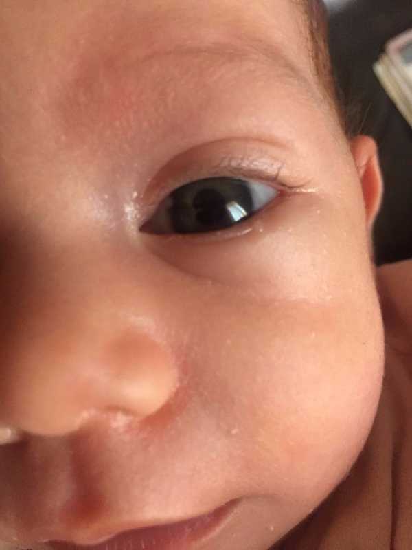 Spot on iris and pupil for a month old