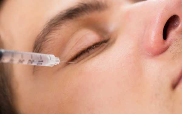 Botox Injection for eye wrinkles