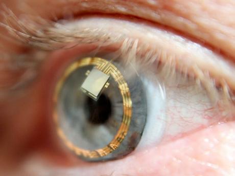Smart Contact Lenses​ that measure intraocular pressure