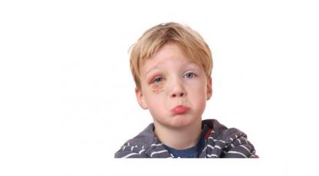 Eye Injuries in Children​