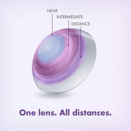 Frequency Multifocal Contact Lenses Bring a New Level of Vision