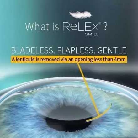 ReLEx SMILE Laser Eye Surgery